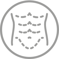 Bauchdeckenstraffung